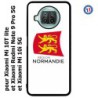 Coque pour Xiaomi Mi 10i 5G Logo Normandie - Écusson Normandie - 2 léopards